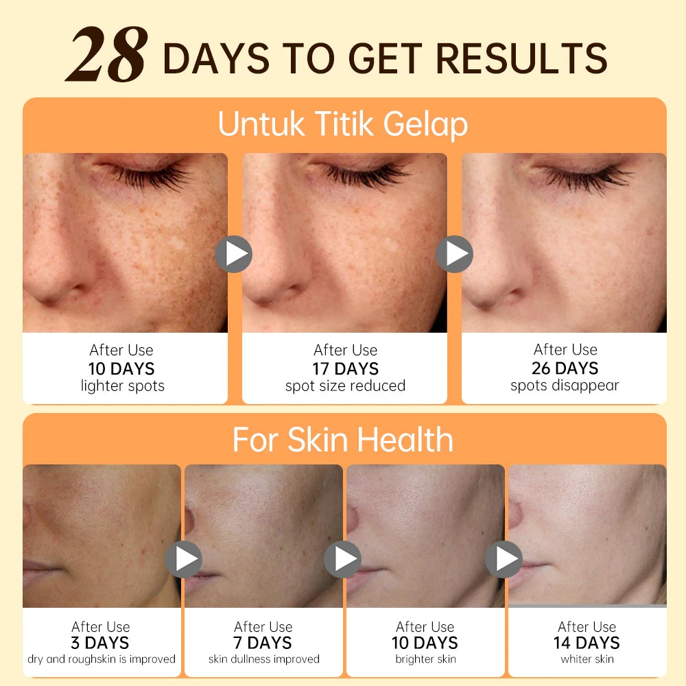 Vitamin C skin care for acne and dull looking face